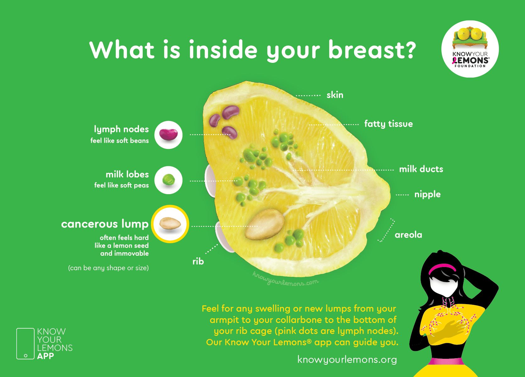 Know your lemons- inside breast poster